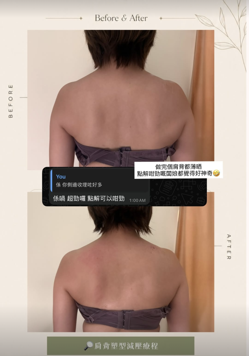 美體案例 03・肩背護理，原圖上方為護理前，下方為護理後